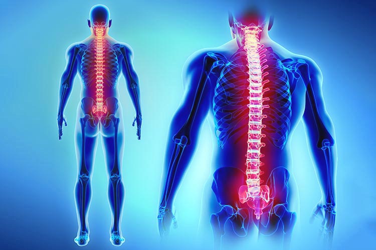 後弯症の原因は何ですか?